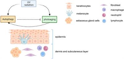 Autophagy plays an essential role in ultraviolet radiation-driven skin photoaging